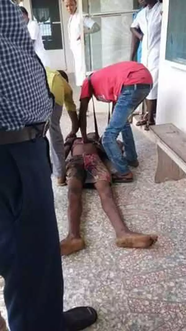 Graphic photos: Guy beats brother to death during fight